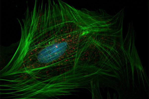 Нейронная сеть Кохонена, самоорганизующиеся карты, обучение. Кохонен